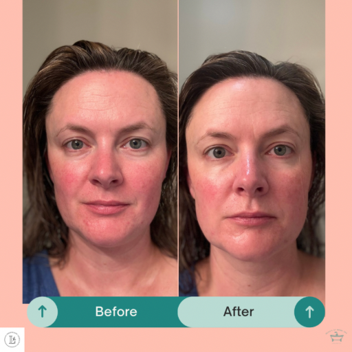 Bakuchiol – Natural Retinol Alternative